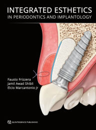 Title: Integrated Esthetics in Periodontics and Implantology, Author: Fausto Frizzera