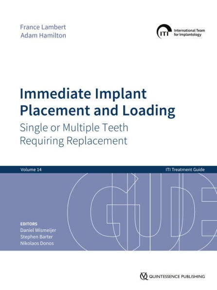 Immediate Implant Placement and Loading - Single or Multiple Teeth Requiring Replacement