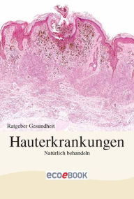 Title: Hauterkrankungen - Natürlich behandeln: Ratgeber Gesundheit, Author: Red. Serges Verlag