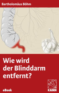 Title: Wie wird der Blinddarm entfernt?, Author: Bartholomäus Böhm