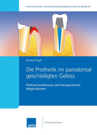 Title: Die Prothetik im parodontal geschädigten Gebiss: Risikoeinschätzung und therapeutische Möglichkeiten, Author: The Bonniwell Music Machine