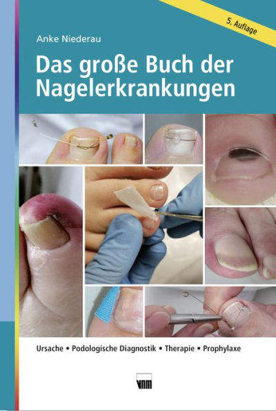 Das große Buch der Nagelerkrankungen: Ursache, Podologische Diagnostik, Therapie, Prophylaxe