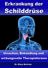 Title: Erkrankung der Schilddrüse - Ursachen, Behandlung und wirkungsvolle Therapieformen, Author: Dr. Klaus Bertram