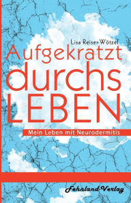 Title: Aufgekratzt durchs Leben. Mein Leben mit Neurodermitis, Author: Lisa Reiser-Wötzel