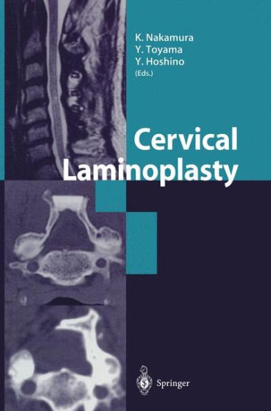 Cervical Laminoplasty / Edition 1