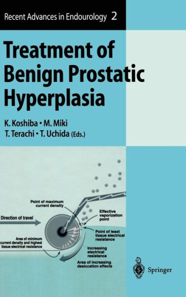 Treatment of Benign Prostatic Hyperplasia