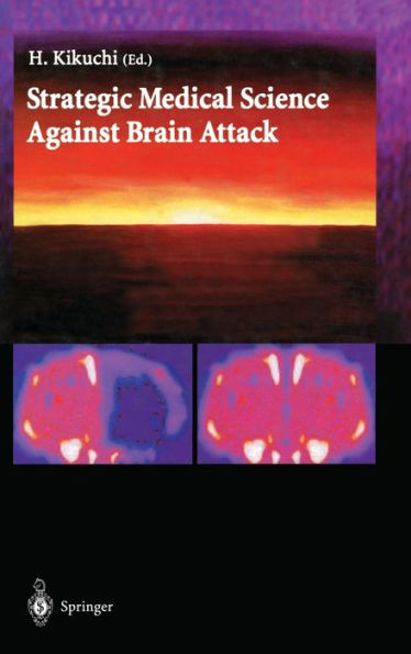 Strategic Medical Science Against Brain Attack