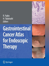 Title: Gastrointestinal Cancer Atlas for Endoscopic Therapy / Edition 1, Author: Rikiya Fujita