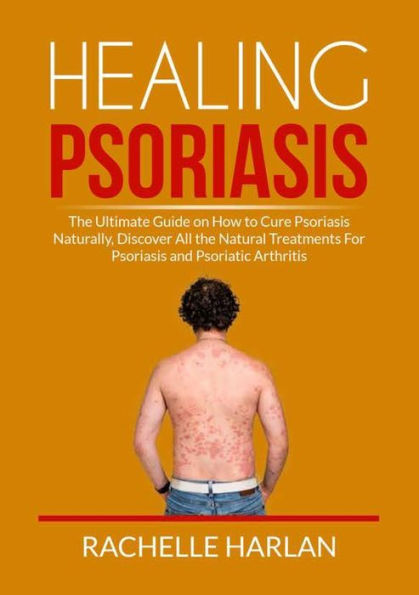 Healing Psoriasis: the Ultimate Guide on How to Cure Psoriasis Naturally, Discover All Natural Treatments For and Psoriatic Arthritis