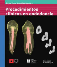 Title: Procedimientos clínicos en endodoncia, Author: Álvaro Cruz González