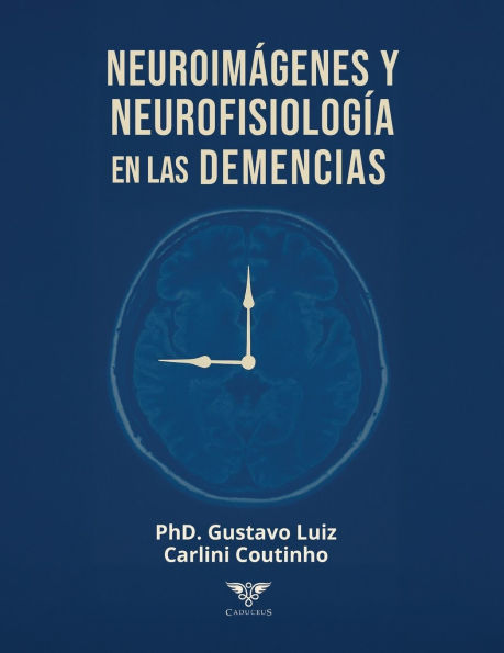 Neuroim�genes y neurofisiolog�a en las demencias