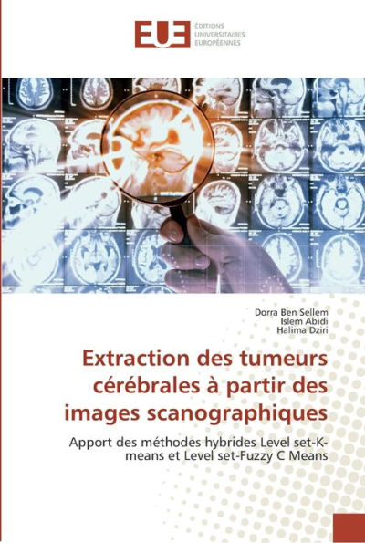 Extraction des tumeurs cérébrales à partir des images scanographiques