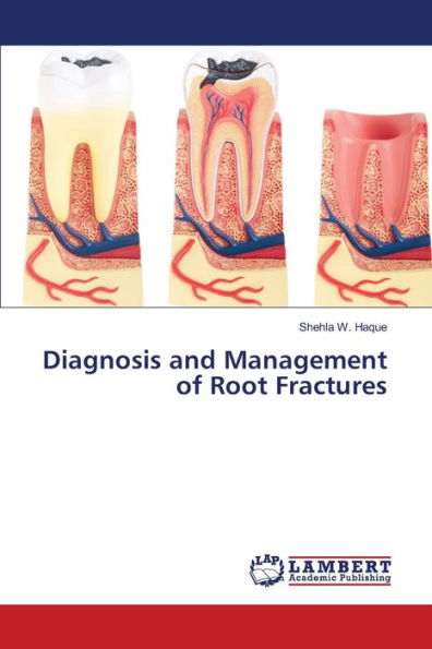 Diagnosis and Management of Root Fractures