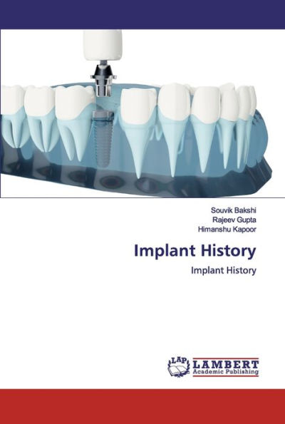 Implant History