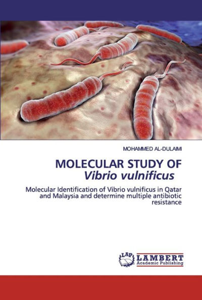 MOLECULAR STUDY OF Vibrio vulnificus