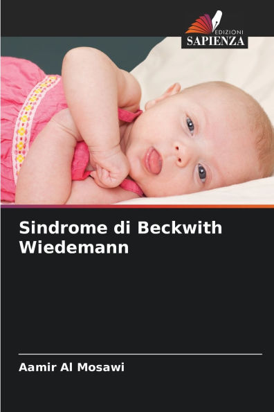 Sindrome di Beckwith Wiedemann