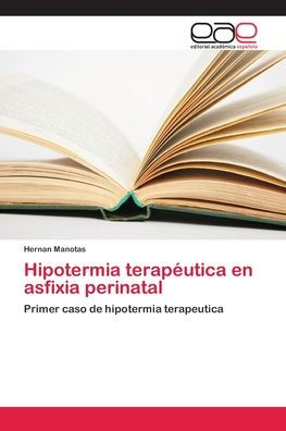 Hipotermia terapéutica en asfixia perinatal
