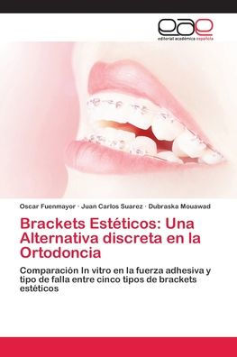 Brackets Estéticos: Una Alternativa discreta en la Ortodoncia