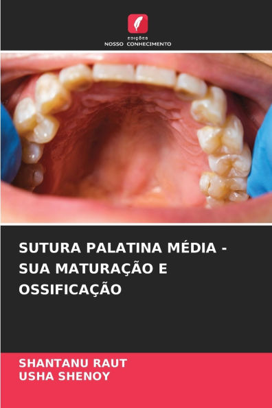 Sutura Palatina MÃ¯Â¿Â½dia - Sua MaturaÃ¯Â¿Â½Ã¯Â¿Â½o E OssificaÃ¯Â¿Â½Ã¯Â¿Â½o