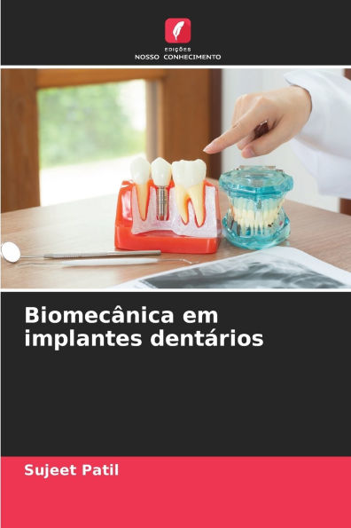 BiomecÃ¯Â¿Â½nica em implantes dentÃ¯Â¿Â½rios