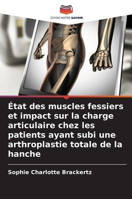 Ã¯Â¿Â½tat des muscles fessiers et impact sur la charge articulaire chez les patients ayant subi une arthroplastie totale de la hanche