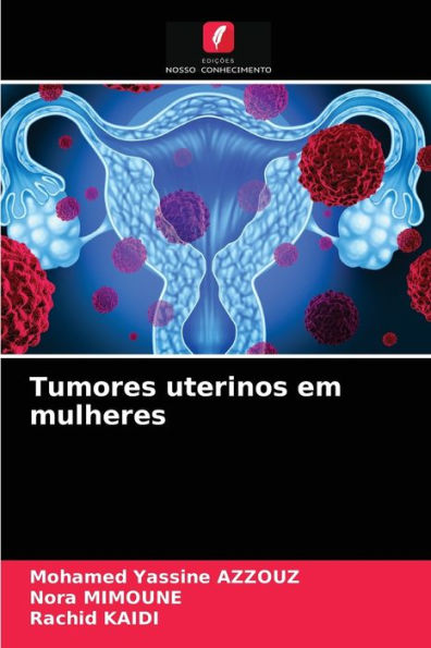 Tumores uterinos em mulheres