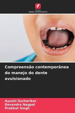 Compreensï¿½o contemporï¿½nea do manejo do dente avulsionado
