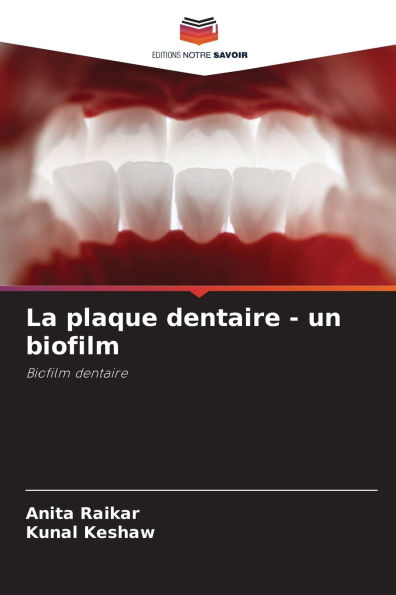 La plaque dentaire - un biofilm