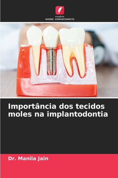 Importï¿½ncia dos tecidos moles na implantodontia