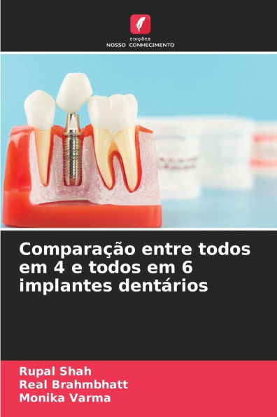 Comparaï¿½ï¿½o entre todos em 4 e todos em 6 implantes dentï¿½rios