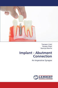 Title: Implant - Abutment Connection, Author: Tasneem Lirani