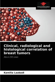 Title: Clinical, radiological and histological correlation of breast tumors, Author: Kamilia Laabadi