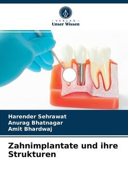 Zahnimplantate und ihre Strukturen