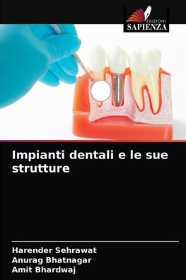 Impianti dentali e le sue strutture