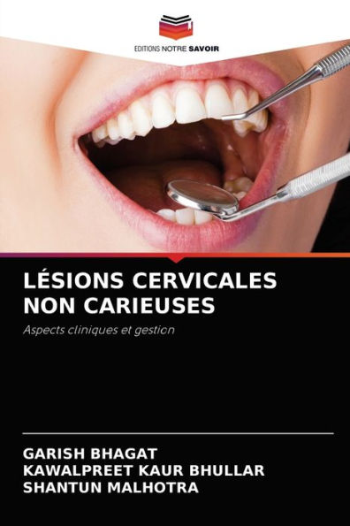 LÉSIONS CERVICALES NON CARIEUSES