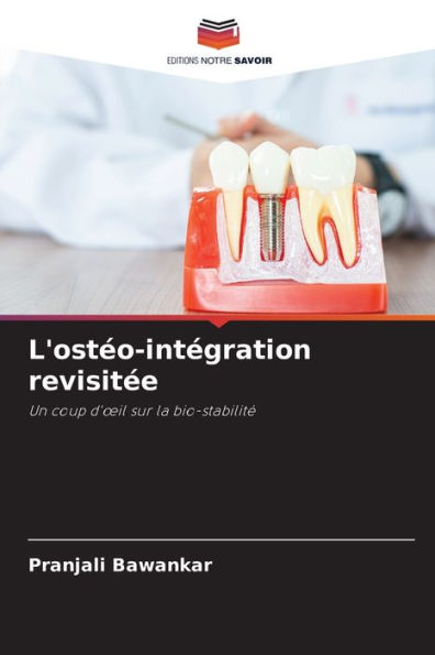 L'ostéo-intégration revisitée