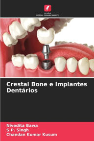 Title: Crestal Bone e Implantes Dentários, Author: Nivedita Bawa
