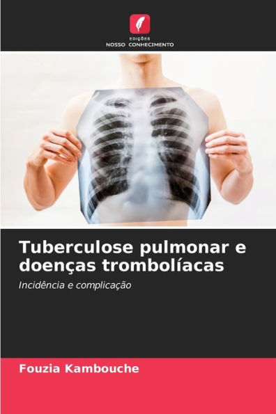 Tuberculose pulmonar e doenças trombolíacas