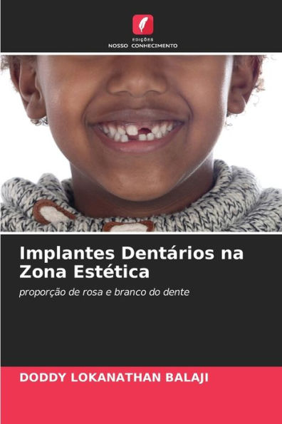 Implantes Dentários na Zona Estética