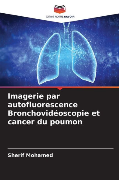 Imagerie par autofluorescence Bronchovidéoscopie et cancer du poumon