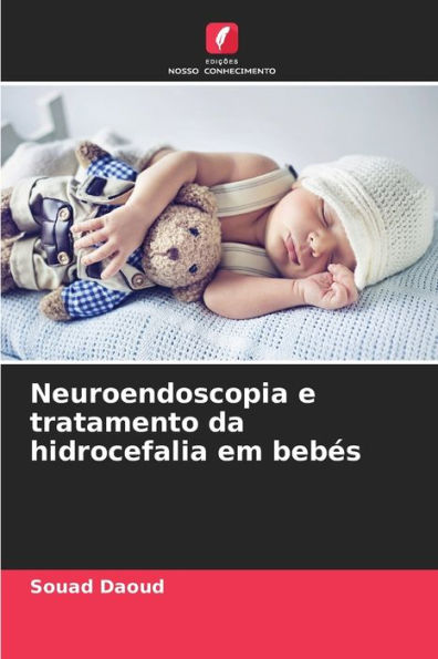 Neuroendoscopia e tratamento da hidrocefalia em bebés