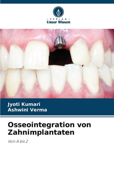 Osseointegration von Zahnimplantaten