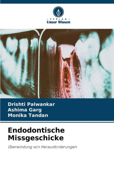 Endodontische Missgeschicke