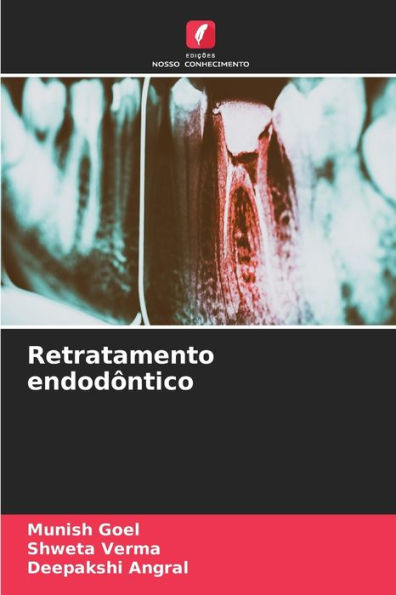 Retratamento endodôntico