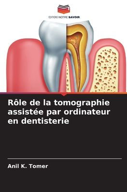 Rôle de la tomographie assistée par ordinateur en dentisterie