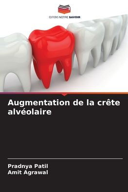 Augmentation de la crête alvéolaire