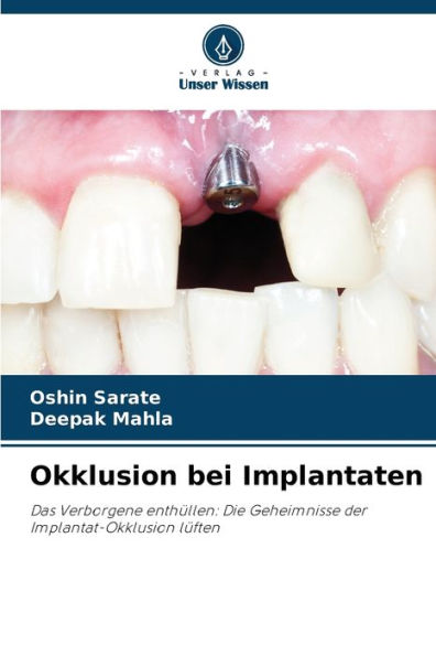 Okklusion bei Implantaten