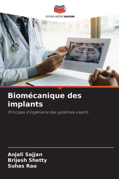 Biomécanique des implants