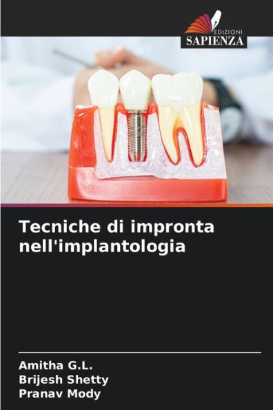 Tecniche di impronta nell'implantologia