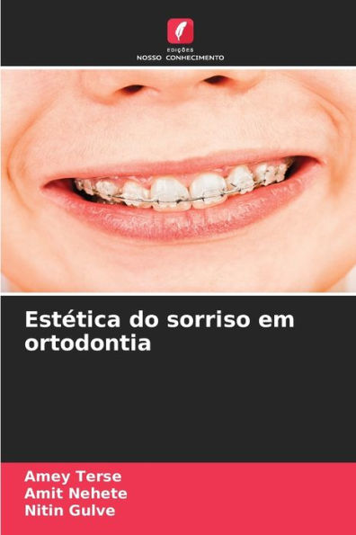 Estética do sorriso em ortodontia